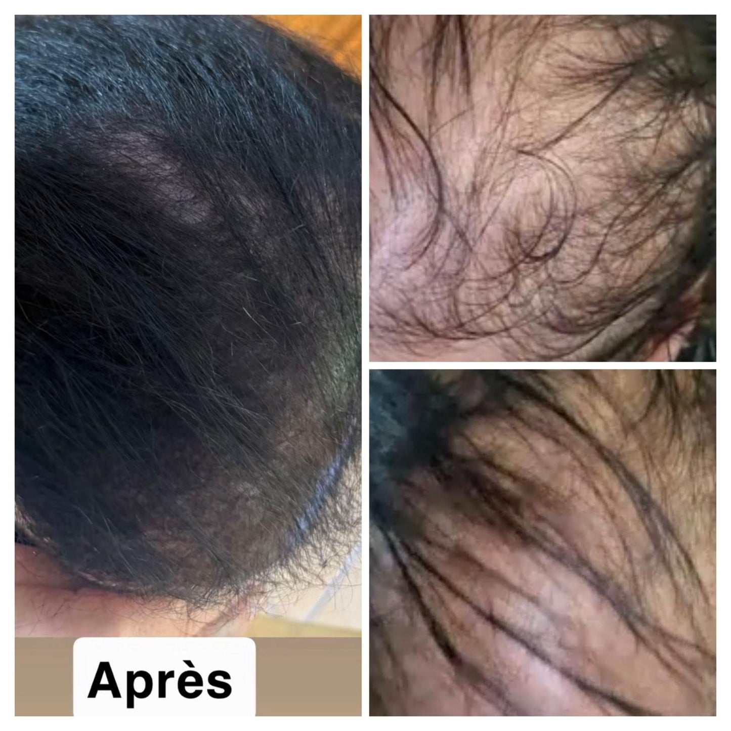 Huile de Batana 100% Pure – Repousse rapide & Cheveux plus denses en 30 jours