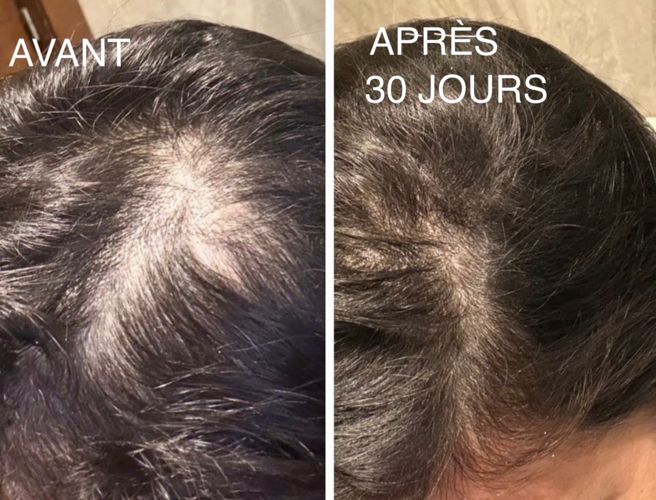 Huile de Batana 100% Pure – Repousse rapide & Cheveux plus denses en 30 jours