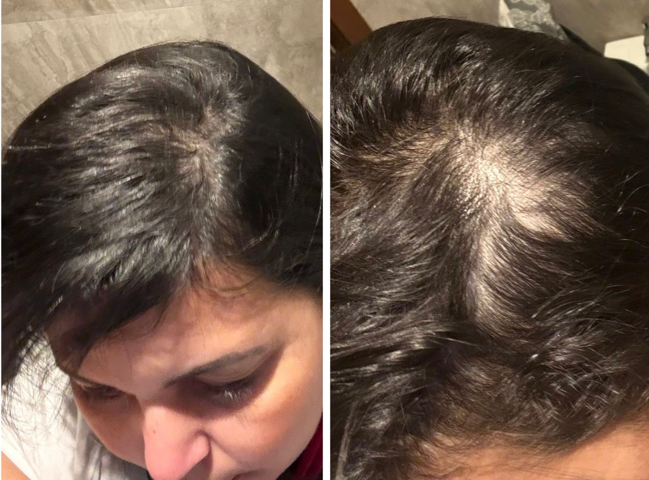 Huile de Batana 100% Pure – Repousse rapide & Cheveux plus denses en 30 jours